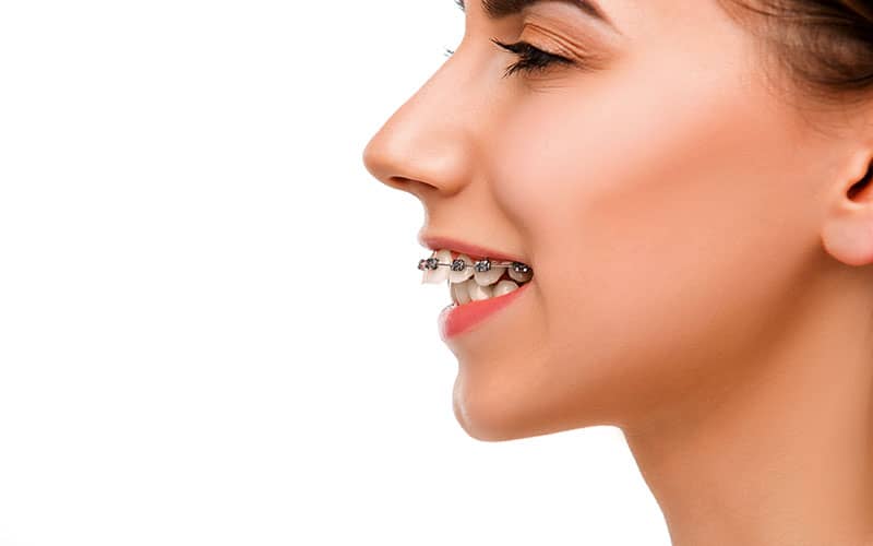 ฟันห่าง